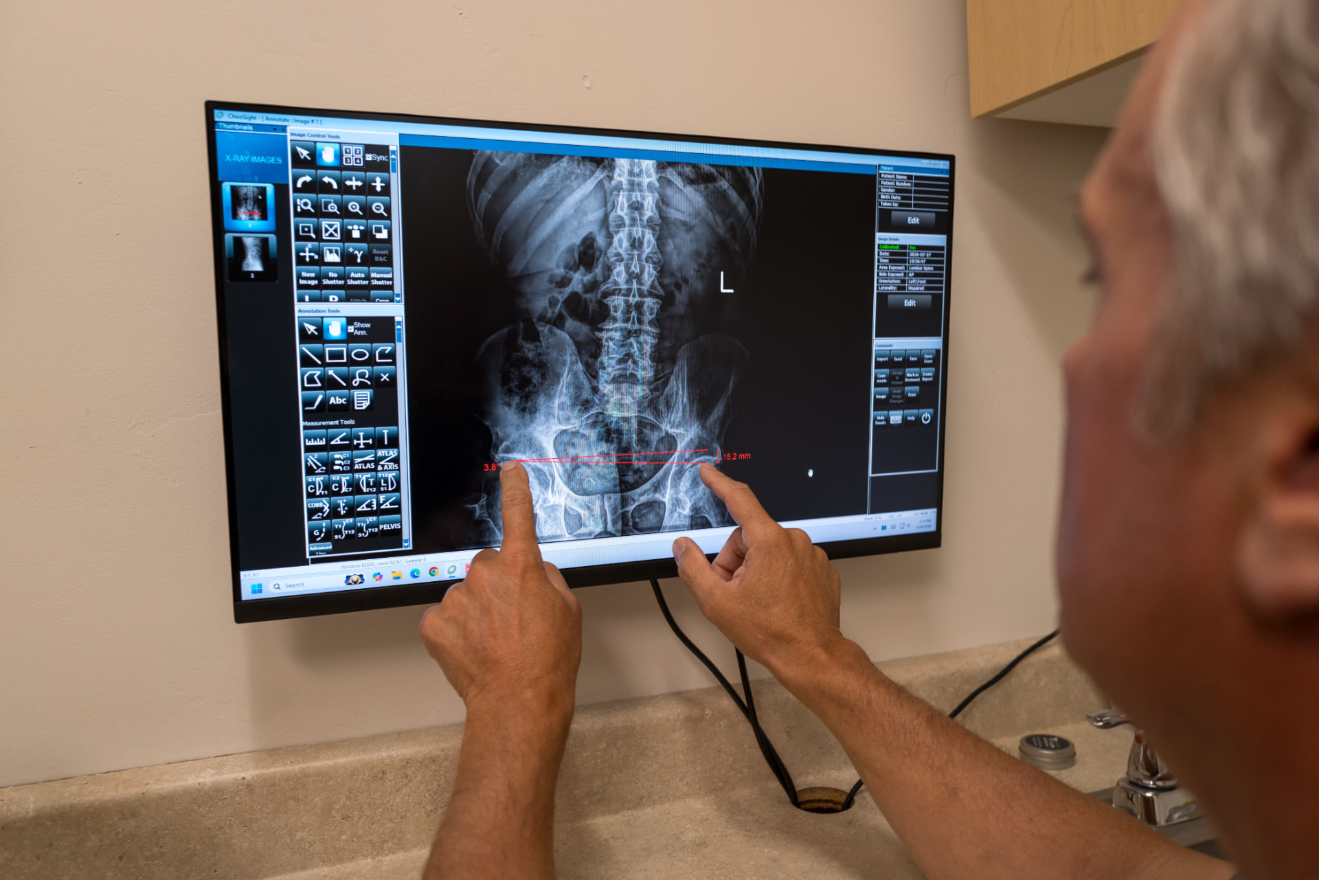 Dr. Lundstrom reviewing a spinal X-ray in clinical practice